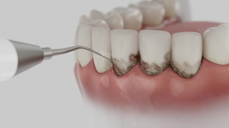Reliable Teeth Cleaning And Checkup contractor in Dorchester County County, MD by Dentist Open Now
